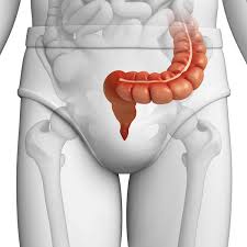 colon iritabil