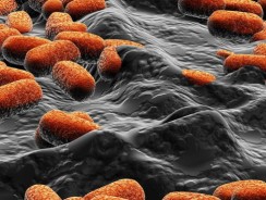 Superbacteriile rezistente la antibiotice ar putea provoca moartea a 2,4 milioane de oameni
